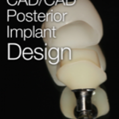 Posterior CAD/CAM Implant Design iBook by James Klim, DDS