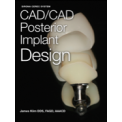 Posterior CAD/CAM Implant Design iBook by James Klim, DDS